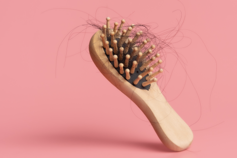 imagen-carrusel-tiroidesTiroides y caída de pelo